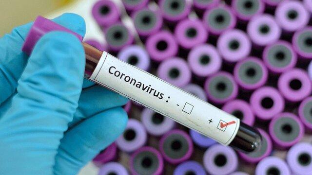 آزمایش تشخیصی ویروس کرونا از فردا در تبریز انجام می گردد