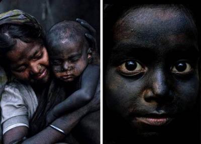 این بچه ها هر روز سیاه تر می شوند!