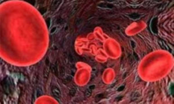 پیشرفت ها در ژنتیک مولکولی سرطان خون بچه ها