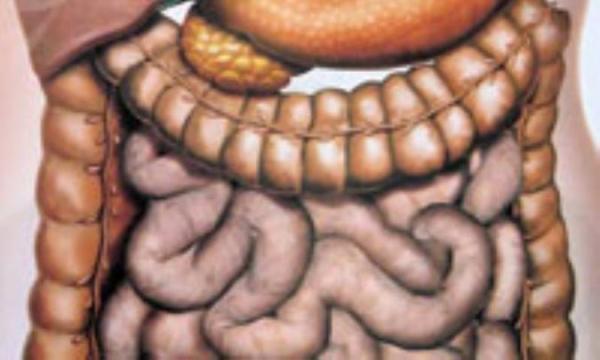 افزایش آمار سرطان روده بزرگ افزایش آمار سرطان روده بزرگ