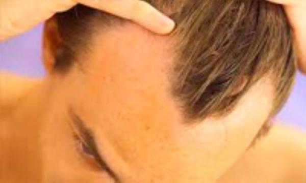 علل شکنندگی موها علل شکنندگی موها